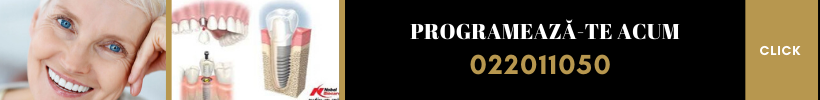 programare implant dentar